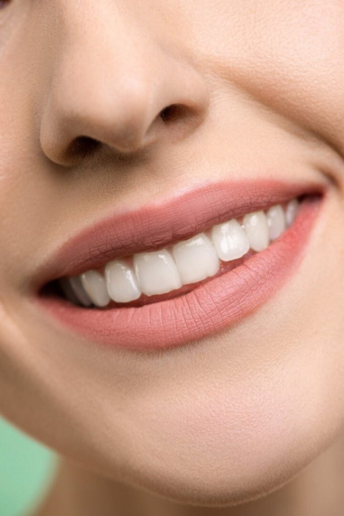 Promena boje zuba i izbeljivanje